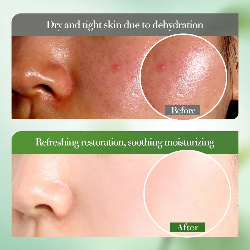 Aloe Vera Gel 100% Natural For Face And Body