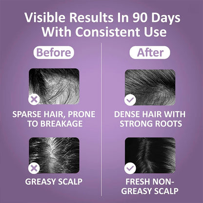 Electric Head Massage Comb Head Vibration Massager Portable Hair Follicle Comb Scalp Oil Liquid Applicator Hair Growth Anti Loss