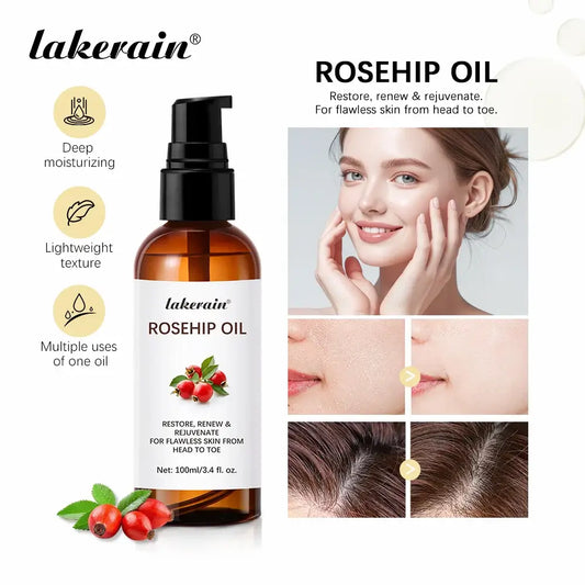 Organic Rosehip Oil Rose Hips Face Oils -Skin Care Moisturizer