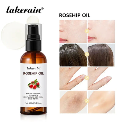 Organic Rosehip Oil Rose Hips Face Oils -Skin Care Moisturizer