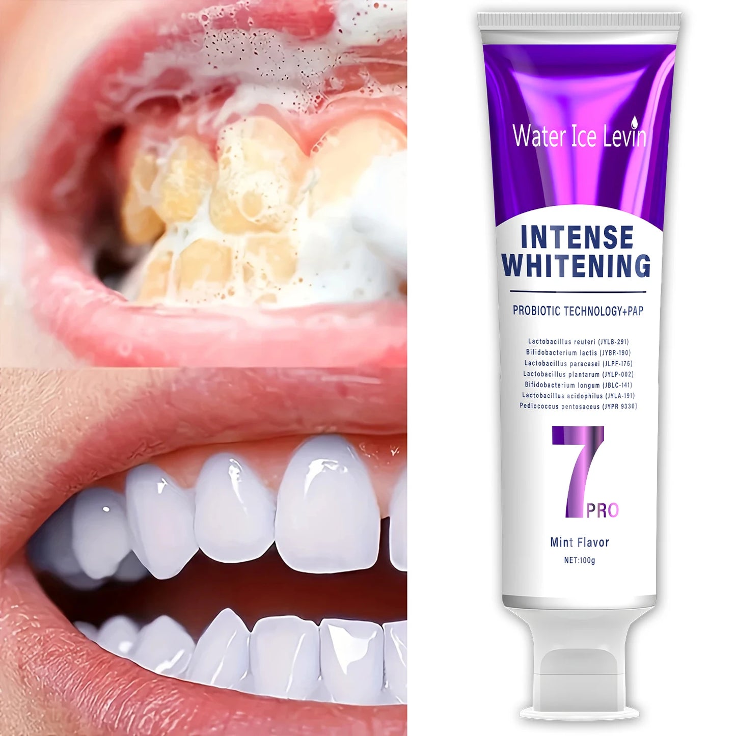 Probiotic Whitening Toothpaste - Helps Maintain Gum Health